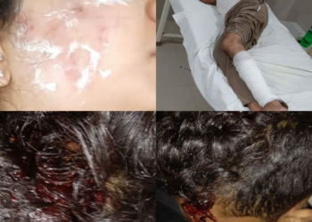 कौशांबी कोखराज पुलिस की लापरवाही