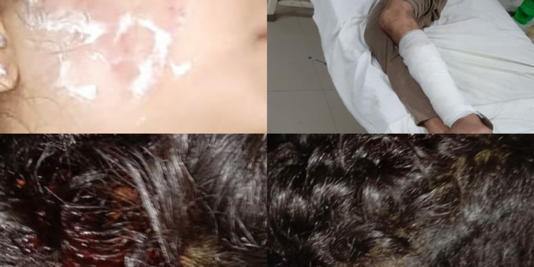 कौशांबी कोखराज पुलिस की लापरवाही