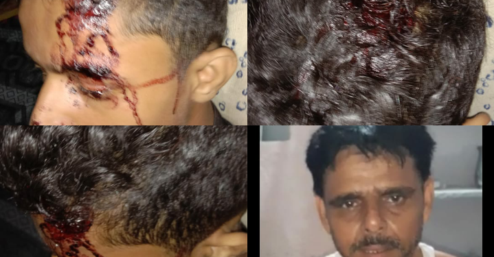 कौशांबी गांव राला थाना कोखराज के मामले में पुलिस की मुस्तैदी की भी पोल खोल दी। 