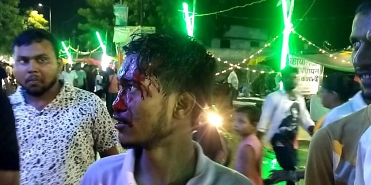 चायल कजली मेला में आए दर्शक पर पुलिस ने किया लाठीचार्ज.