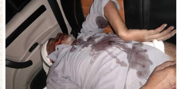 चित्रकूट NH35 पर शव मिलने से मचा हड़कंप ।